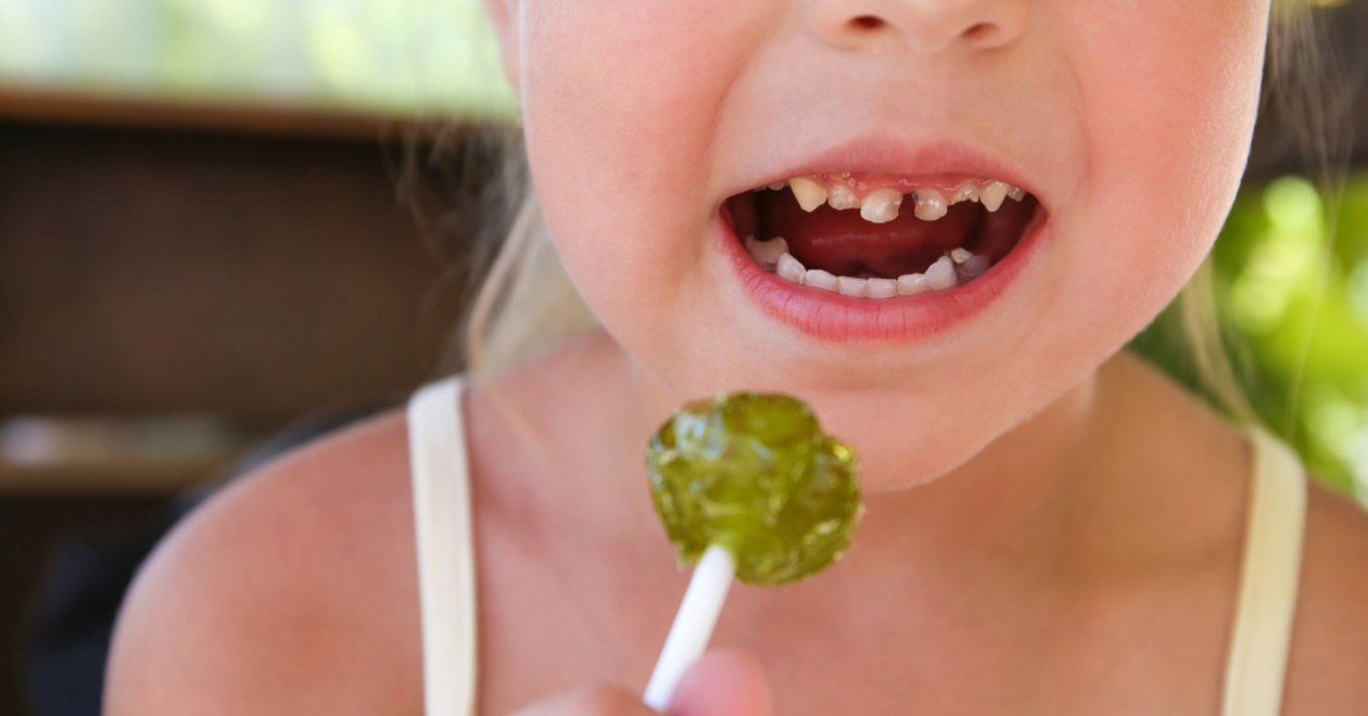 Miért feketedik be a gyerekek foga? Így előzheted meg